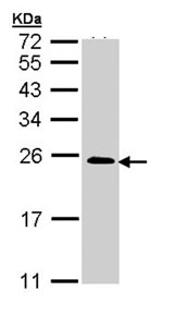 Western blot - Anti-TC21 antibody (AB96307), expandable thumbnail