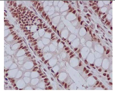 Immunohistochemistry (Formalin/PFA-fixed paraffin-embedded sections) - Anti-TCEA1 antibody [EPR14820(B)] (AB184181), expandable thumbnail