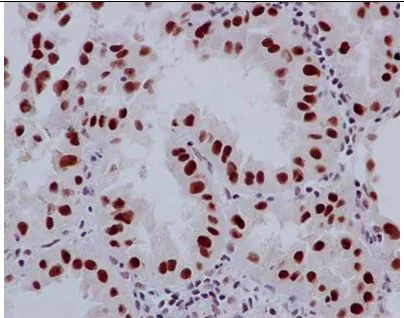 Immunohistochemistry (Formalin/PFA-fixed paraffin-embedded sections) - Anti-TCEA1 antibody [EPR14820(B)] - BSA and Azide free (AB250735)