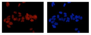 Immunocytochemistry/ Immunofluorescence - Anti-TCEA1 + TCEA2 + TCEA3 antibody [EPR14821] (AB185947), expandable thumbnail