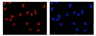 Immunocytochemistry/ Immunofluorescence - Anti-TCEA1 + TCEA2 + TCEA3 antibody [EPR14821] (AB185947), expandable thumbnail