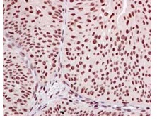 Immunohistochemistry (Formalin/PFA-fixed paraffin-embedded sections) - Anti-TCEA1 + TCEA2 + TCEA3 antibody [EPR14821] (AB185947), expandable thumbnail