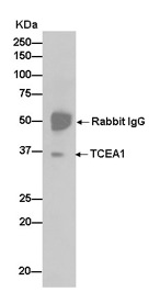 Immunoprecipitation - Anti-TCEA1 + TCEA2 + TCEA3 antibody [EPR14821] (AB185947), expandable thumbnail