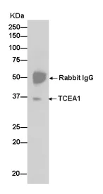 Immunoprecipitation - Anti-TCEA1 + TCEA2 + TCEA3 antibody [EPR14821] - BSA and Azide free (AB242405)