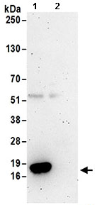 Immunoprecipitation - Anti-TCEB2/Elongin-B antibody (AB168836)