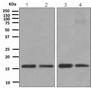 Western blot - Anti-TCEB2/Elongin-B antibody [EPR10440(B)] (AB151743), expandable thumbnail