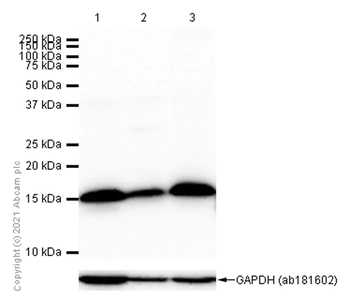 Western blot - Anti-TCEB2/Elongin-B antibody [EPR10441(B)] (AB154854)