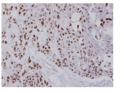 Immunohistochemistry (Formalin/PFA-fixed paraffin-embedded sections) - Anti-TCF-25 antibody (AB96813)