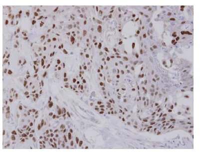 Immunohistochemistry (Formalin/PFA-fixed paraffin-embedded sections) - Anti-TCF-25 antibody (AB96813)
