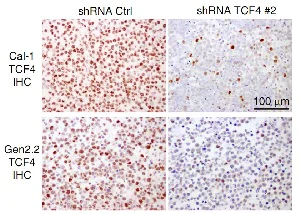 Immunohistochemistry (Formalin/PFA-fixed paraffin-embedded sections) - Anti-TCF-4 antibody [NCI-R159-6] - BSA and Azide free (AB223073)