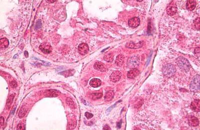 Immunohistochemistry (Formalin/PFA-fixed paraffin-embedded sections) - Anti-TCF-4/TCF7L2 antibody (AB134275)