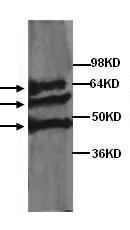 Western blot - Anti-TCF-4/TCF7L2 antibody (AB134275)