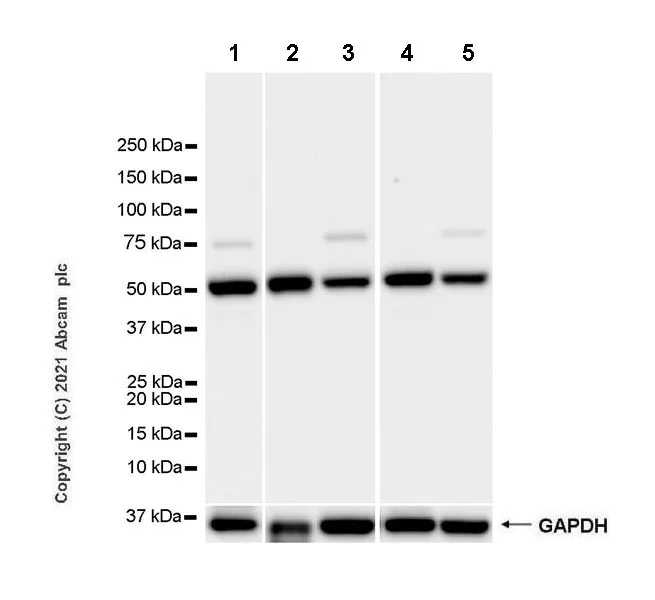 Western blot - Anti-TCF-4/TCF7L2+TCF-3/TCF7L1 antibody [EPR24701-87] - BSA and Azide free (AB283718)