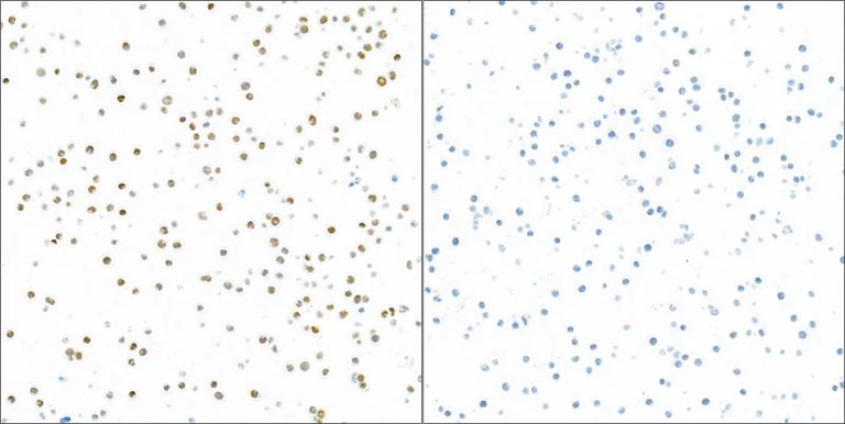 Immunocytochemistry - Anti-TCF1/TCF7 antibody [BLR228K] - BSA free (AB314082)