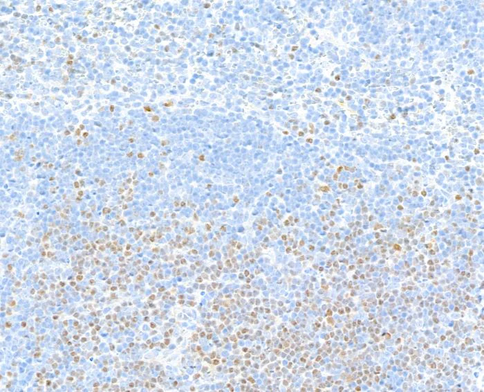 Immunohistochemistry (Formalin/PFA-fixed paraffin-embedded sections) - Anti-TCF1/TCF7 antibody [BLR228K] - BSA free (AB314082)