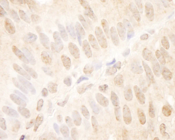 Immunohistochemistry (Formalin/PFA-fixed paraffin-embedded sections) - Anti-TCF12 antibody (AB70746)