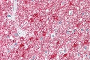 Immunohistochemistry (Formalin/PFA-fixed paraffin-embedded sections) - Anti-TCF19/SC1 antibody (AB155391)