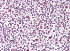 Immunohistochemistry (Formalin/PFA-fixed paraffin-embedded sections) - Anti-TCF19/SC1 antibody (AB155391)