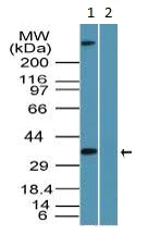Western blot - Anti-TCF19/SC1 antibody (AB155391)