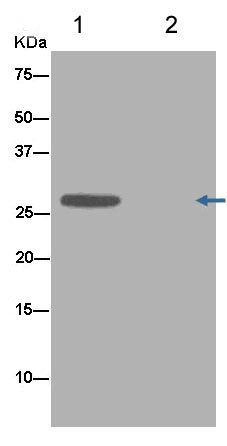 Anti-TCF21 antibody [EPR13449]