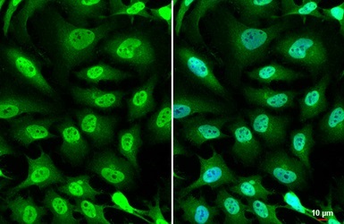 Immunocytochemistry/ Immunofluorescence - Anti-TCF3 / E2A antibody (AB228699)