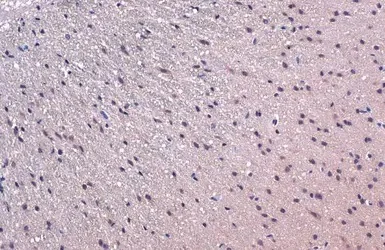 Immunohistochemistry (Formalin/PFA-fixed paraffin-embedded sections) - Anti-TCF3 / E2A antibody (AB228699)