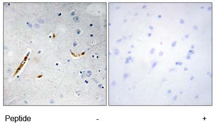 Immunohistochemistry (Formalin/PFA-fixed paraffin-embedded sections) - Anti-TCF3 / E2A antibody (AB69999)