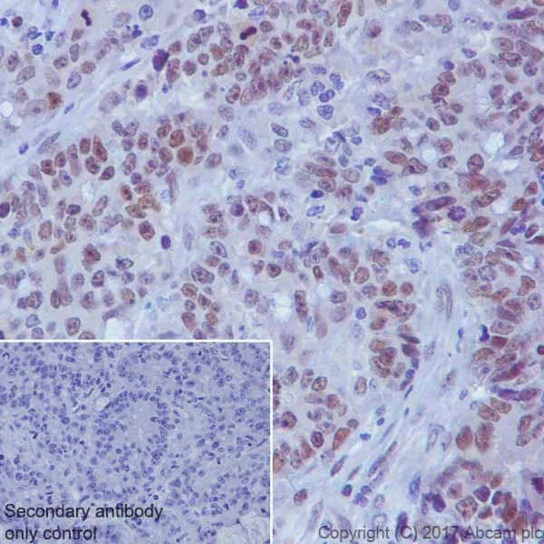 Immunohistochemistry (Formalin/PFA-fixed paraffin-embedded sections) - Anti-TCF3 / E2A antibody [EPR20682] (AB224638)