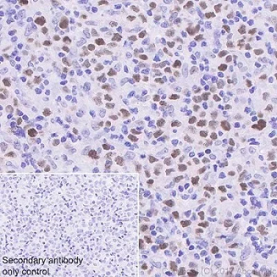 Immunohistochemistry (Formalin/PFA-fixed paraffin-embedded sections) - Anti-TCF3 / E2A antibody [EPR20682] (AB224638)