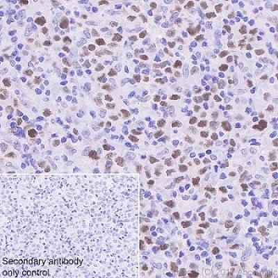 Immunohistochemistry (Formalin/PFA-fixed paraffin-embedded sections) - Anti-TCF3 / E2A antibody [EPR20682] - BSA and Azide free (AB251582)