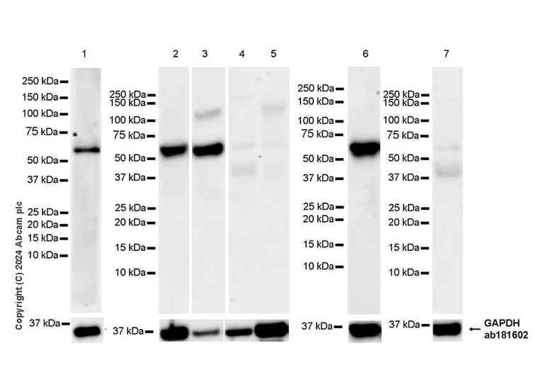 Western blot - Anti-TCF3 / E2A antibody [EPR26691-38] - BSA and Azide free (AB316148)