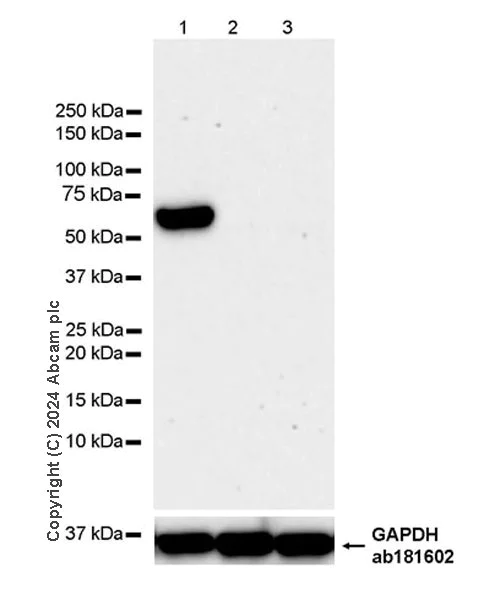 Western blot - Anti-TCF3 / E2A antibody [EPR26691-38] - BSA and Azide free (AB316148)