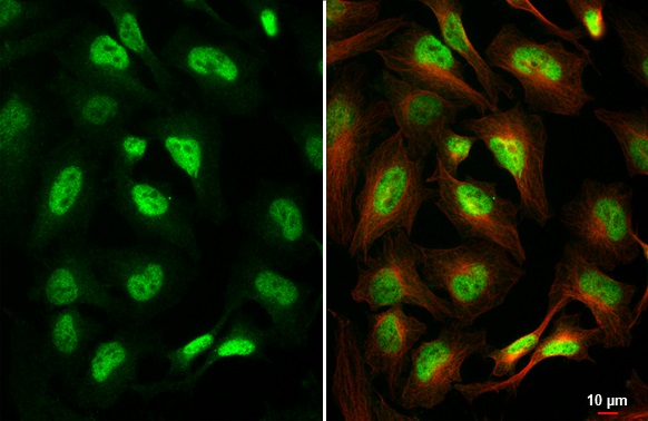 Immunocytochemistry/ Immunofluorescence - Anti-TCF3 / E2A antibody [HL1954] (AB308211), expandable thumbnail