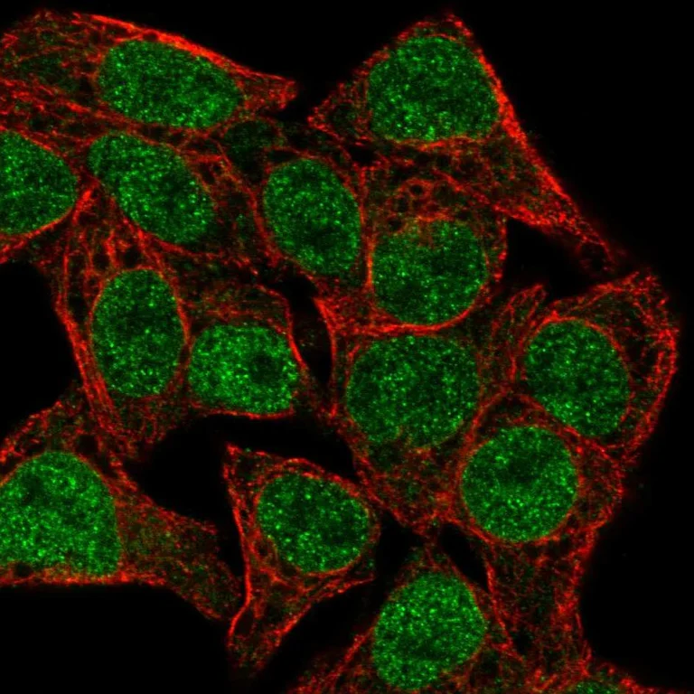 Immunocytochemistry/ Immunofluorescence - Anti-TCF7 Antibody (AB327273)