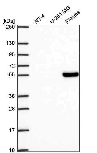 Western blot - Anti-TCF7 Antibody (AB327273)