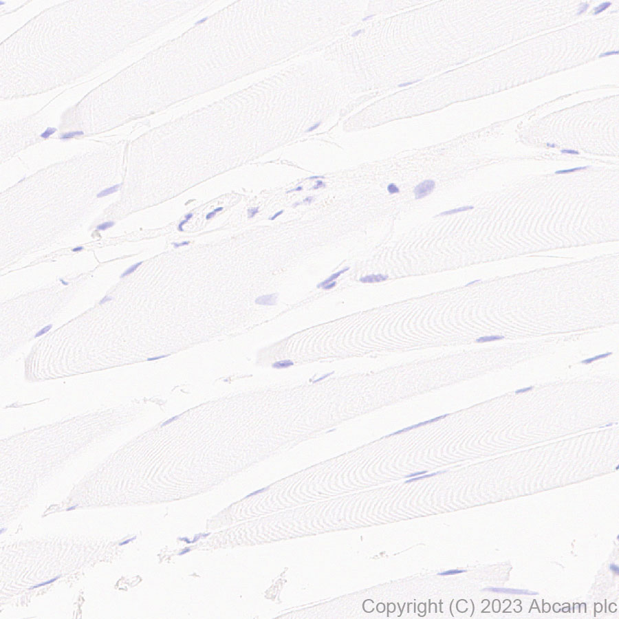 Immunohistochemistry (Formalin/PFA-fixed paraffin-embedded sections) - Anti-TCF7 antibody [EPR28579-32] - BSA and Azide free (ab315391), expandable thumbnail