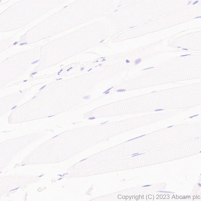 Immunohistochemistry (Formalin/PFA-fixed paraffin-embedded sections) - Anti-TCF7 antibody [EPR28579-32] - BSA and Azide free (AB315391)