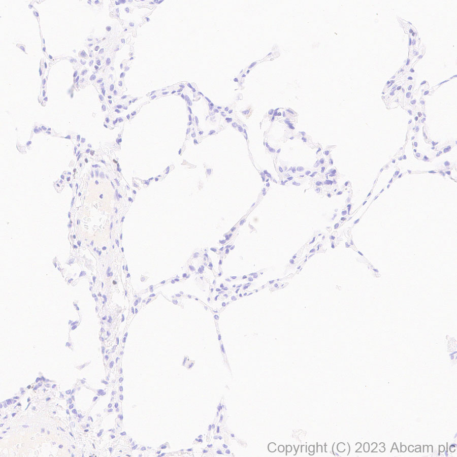 Immunohistochemistry (Formalin/PFA-fixed paraffin-embedded sections) - Anti-TCF7 antibody [EPR28579-32] - BSA and Azide free (ab315391), expandable thumbnail