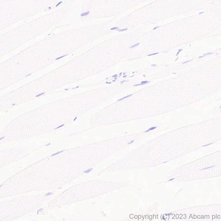 Immunohistochemistry (Formalin/PFA-fixed paraffin-embedded sections) - Anti-TCF7 antibody [EPR28579-5] - BSA and Azide free (AB315393)