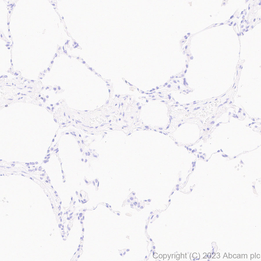 Immunohistochemistry (Formalin/PFA-fixed paraffin-embedded sections) - Anti-TCF7 antibody [EPR28579-5] - BSA and Azide free (ab315393), expandable thumbnail