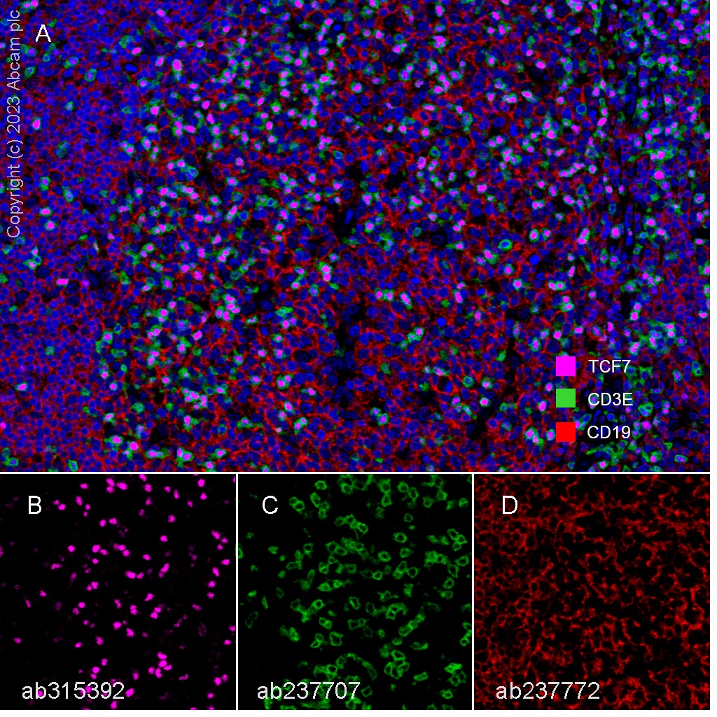 Multiplex immunohistochemistry - Anti-TCF7 antibody [EPR28579-5] - BSA and Azide free (AB315393), expandable thumbnail