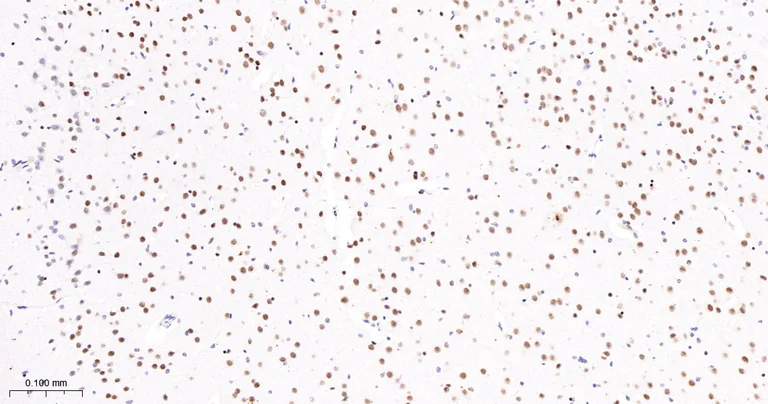 Immunohistochemistry (Formalin/PFA-fixed paraffin-embedded sections) - Anti-TCF7L2 antibody [2C2] (AB326709)