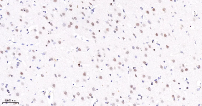 Immunohistochemistry (Formalin/PFA-fixed paraffin-embedded sections) - Anti-TCF7L2 antibody [2C2] (AB326709)