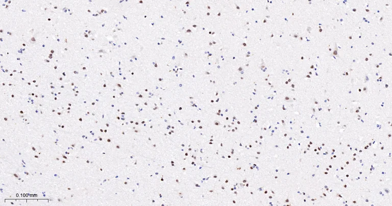 Immunohistochemistry (Formalin/PFA-fixed paraffin-embedded sections) - Anti-TCF7L2 antibody [2C2] (AB326709)