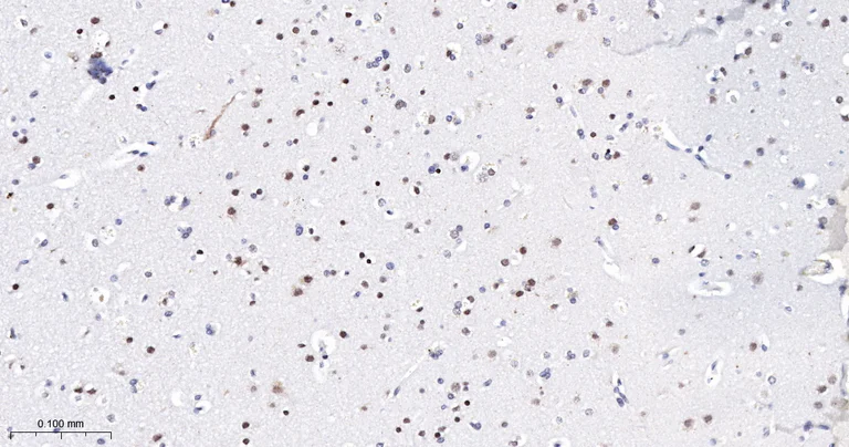 Immunohistochemistry (Formalin/PFA-fixed paraffin-embedded sections) - Anti-TCF7L2 antibody [2C2] (AB326709)