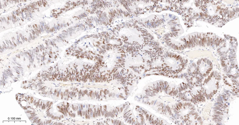 Immunohistochemistry (Formalin/PFA-fixed paraffin-embedded sections) - Anti-TCF7L2 antibody [2C2] (AB326709)