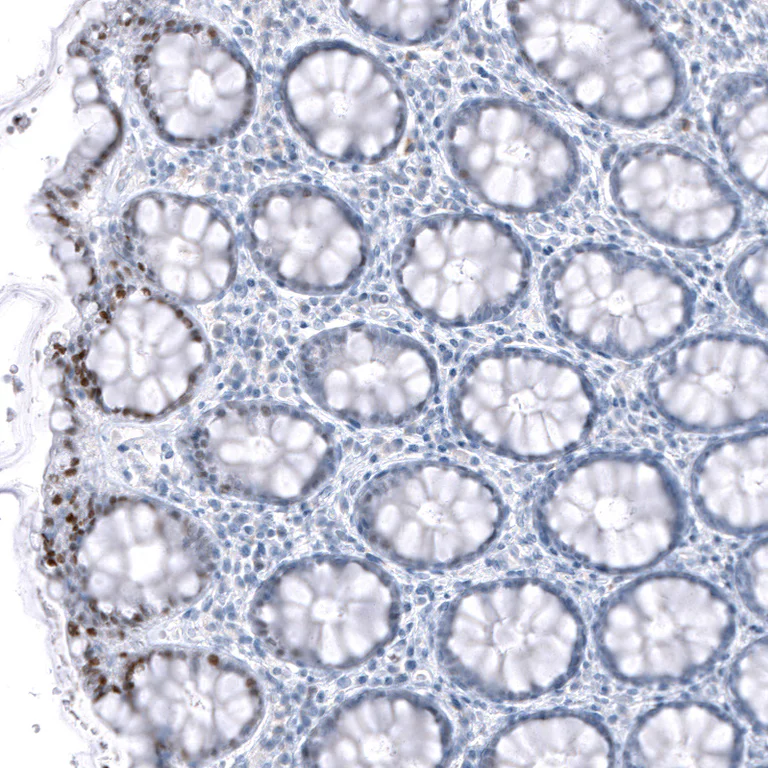 Immunohistochemistry (Formalin/PFA-fixed paraffin-embedded sections) - Anti-TCF7L2 Antibody [CL11547] (AB327135)