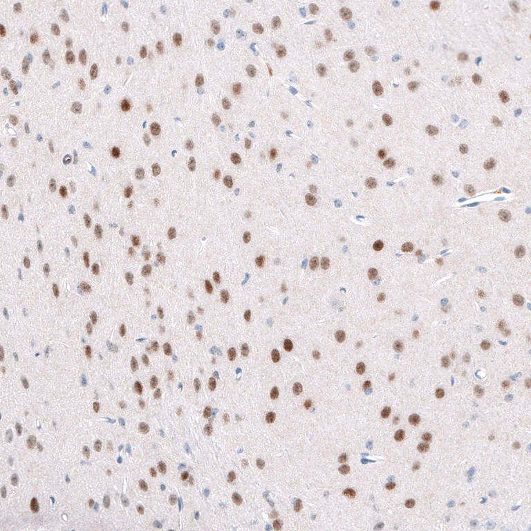 Immunohistochemistry (Formalin/PFA-fixed paraffin-embedded sections) - Anti-TCF7L2 Antibody [CL11547] (AB327135)