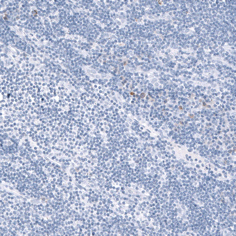 Immunohistochemistry (Formalin/PFA-fixed paraffin-embedded sections) - Anti-TCF7L2 Antibody [CL11547] (AB327135)