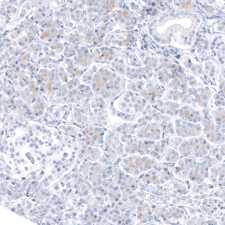 Immunohistochemistry (Formalin/PFA-fixed paraffin-embedded sections) - Anti-TCF7L2 Antibody [CL11547] (AB327135)